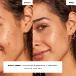 Glow Recipe Strawberry Smooth BHA+AHA Salicylic Serum – 30ml - Image 4