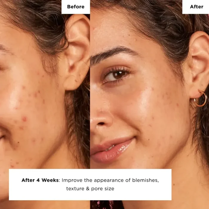 Glow Recipe Strawberry Smooth BHA+AHA Salicylic Serum – 30ml - Image 4