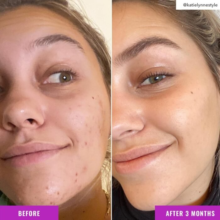 Minimalist Niacinamide 10% Face Serum – 30ml - Image 4