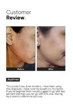 Minimalist Niacinamide 10% Face Serum – 30ml - Image 5