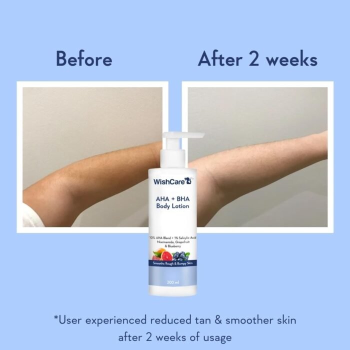 WishCare AHA + BHA Body Lotion – 200ml - Image 4