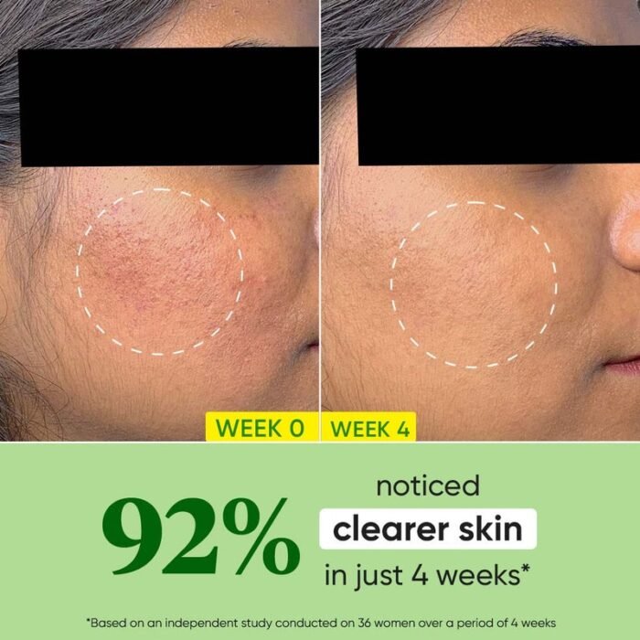 Dot & Key Cica Calming Oil Free Moisturizer For Acne Prone skin – 60ml - Image 4