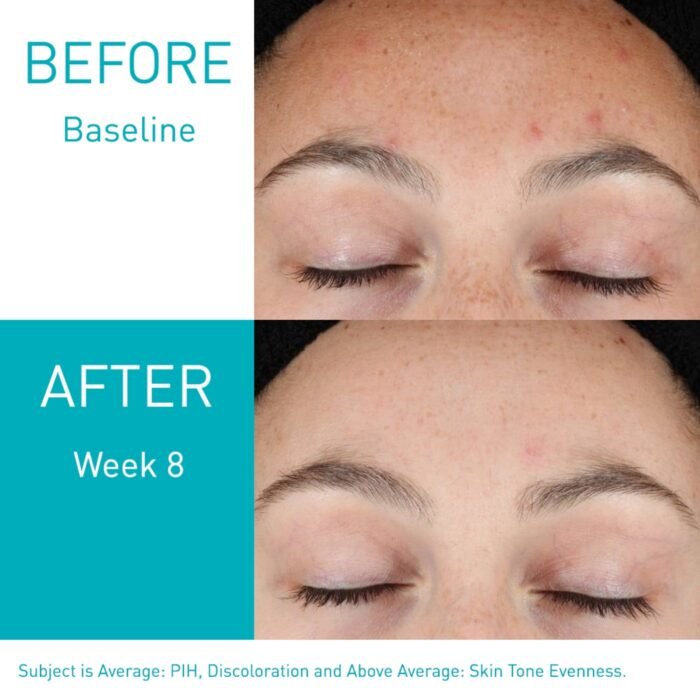 CeraVe Resurfacing Retinol Serum – 30ml - Image 4