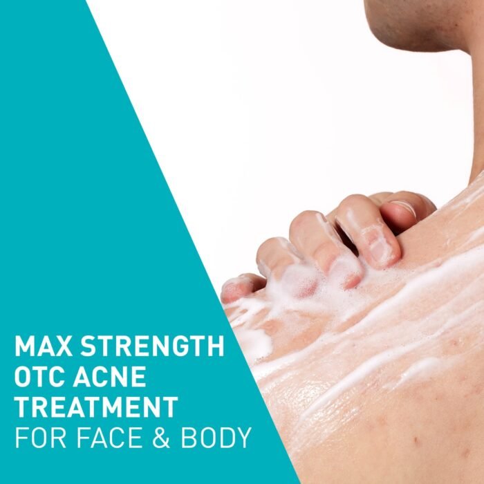 CeraVe Acne Foaming Cream Wash ( benzoyl peroxide 10% ) – 150ml - Image 5