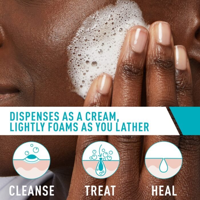 CeraVe Acne Foaming Cream Cleanser – 150ml - Image 4