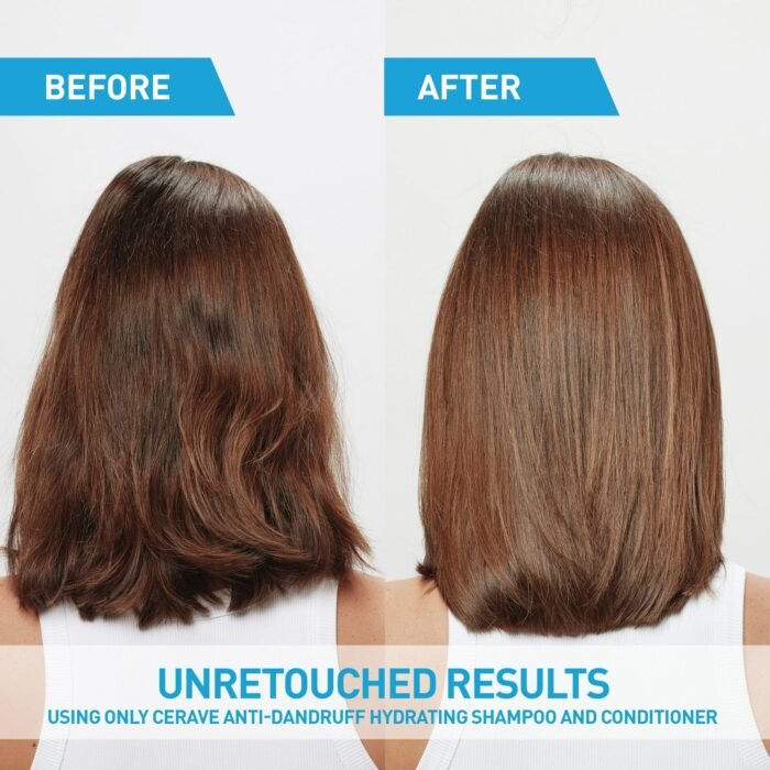 CeraVe Anti-Dandruff Hydrating Conditioner – 266ml - Image 7