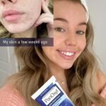 PanOxyl Acne Creamy Wash – 170g - Image 3