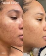 ANUA Peach 70% Niacinamide Serum – 30ml - Image 6